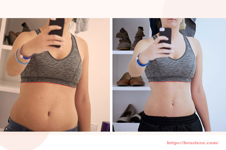 What Actually Happens to Breast Tissue When You Lose or Gain Weight